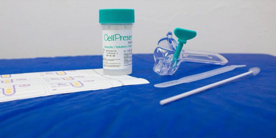 saiba-como-e-o-novo-teste-do-sus-para-detectar-cancer-de-colo-do-utero